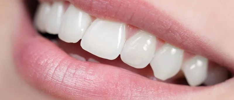 Weiße Zähne nach einem Bleaching